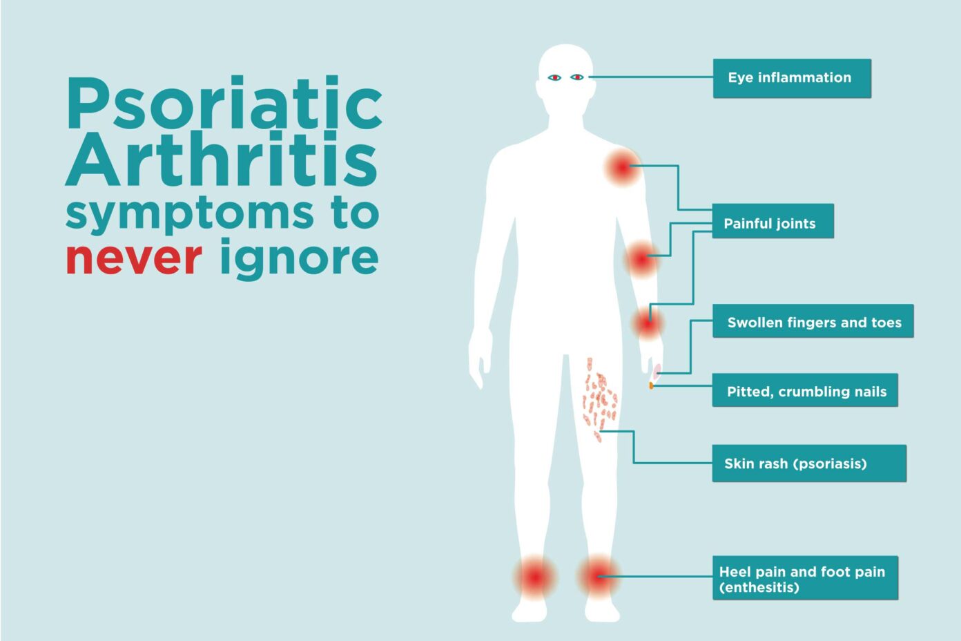 what is psoriatic arthritis - what is psoriatic arthritiswhat is ...